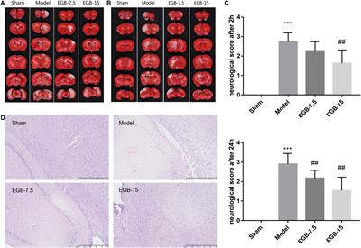 Ginkgo biloba Extract Inhibits Astrocytic Lipocalin-2 Expression and Alleviates Neuroinflammatory Injury via the JAK2/STAT3 Pathway After Ischemic Brain Stroke